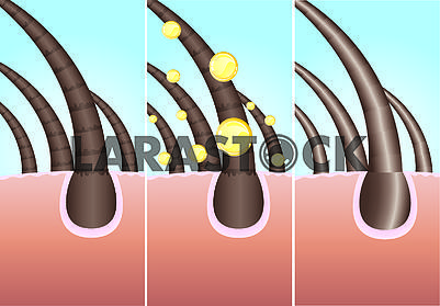 Illustration of three phase of hair cure